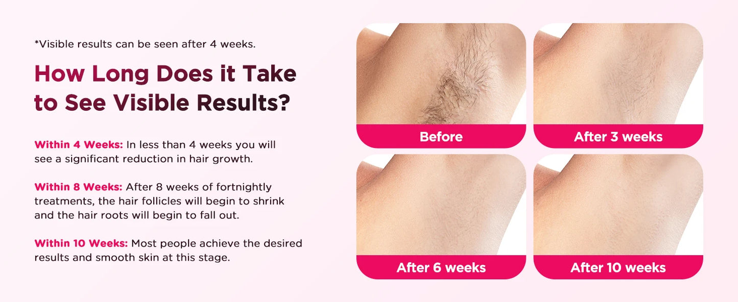 ice cool hair removal device
