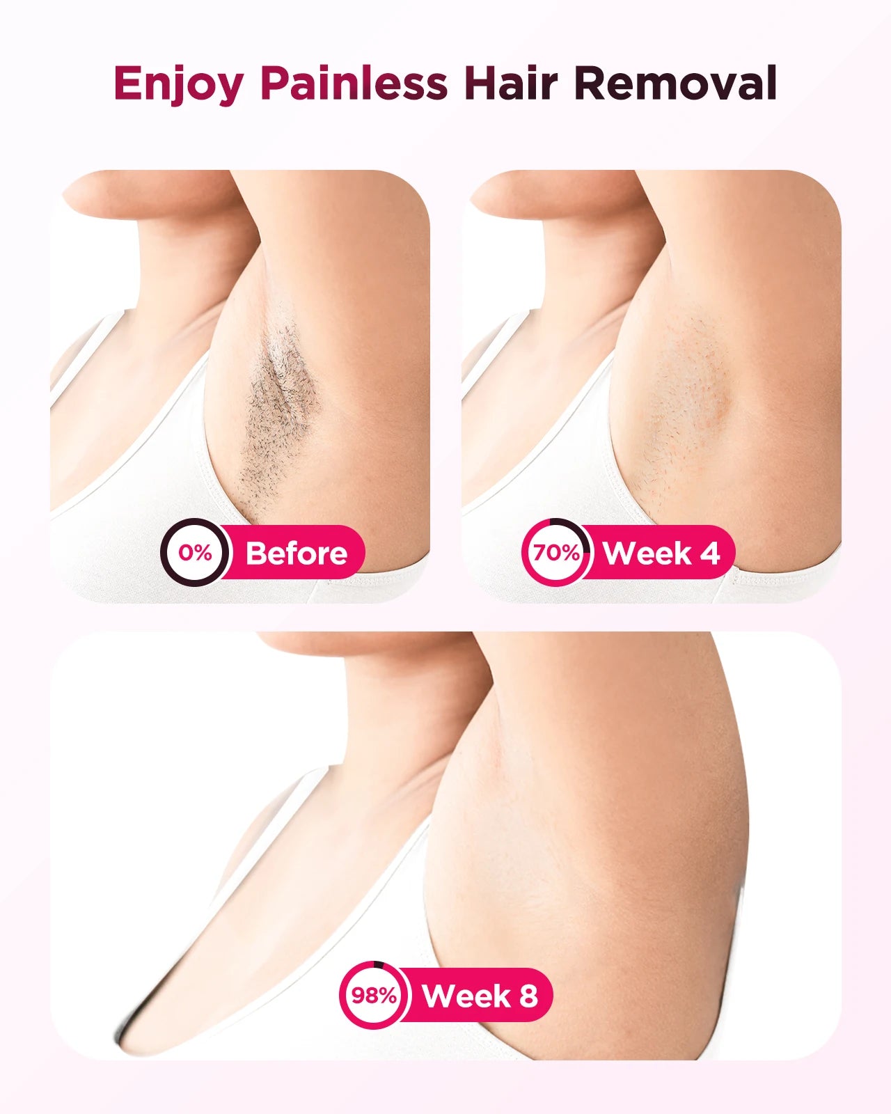 ice cool hair removal device